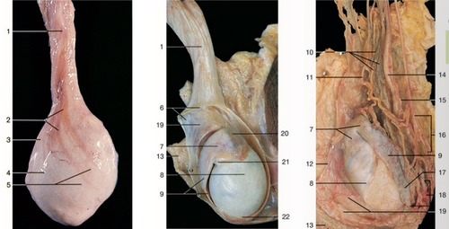 Male Reproductive — Internal spermatic fascia with (Lab 8, Slide 10), fully labeled