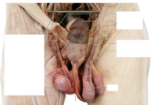 Male Reproductive — Testicular artery and pampiniform (Lab 8, Slide 3), fully labeled