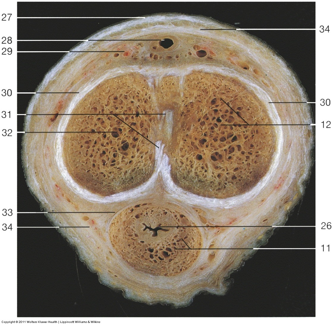 Male Reproductive — Tunica albuginea of corpus (Lab 2, Slide 6), fully labeled