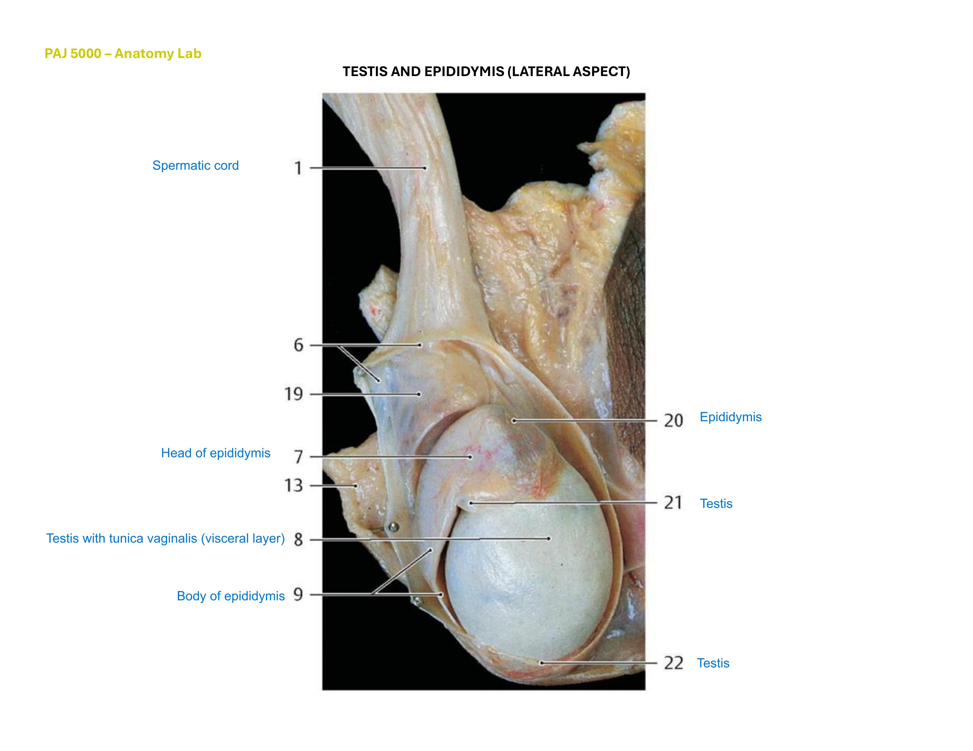 Testis and Epididymis (Lateral Aspect), fully labeled
