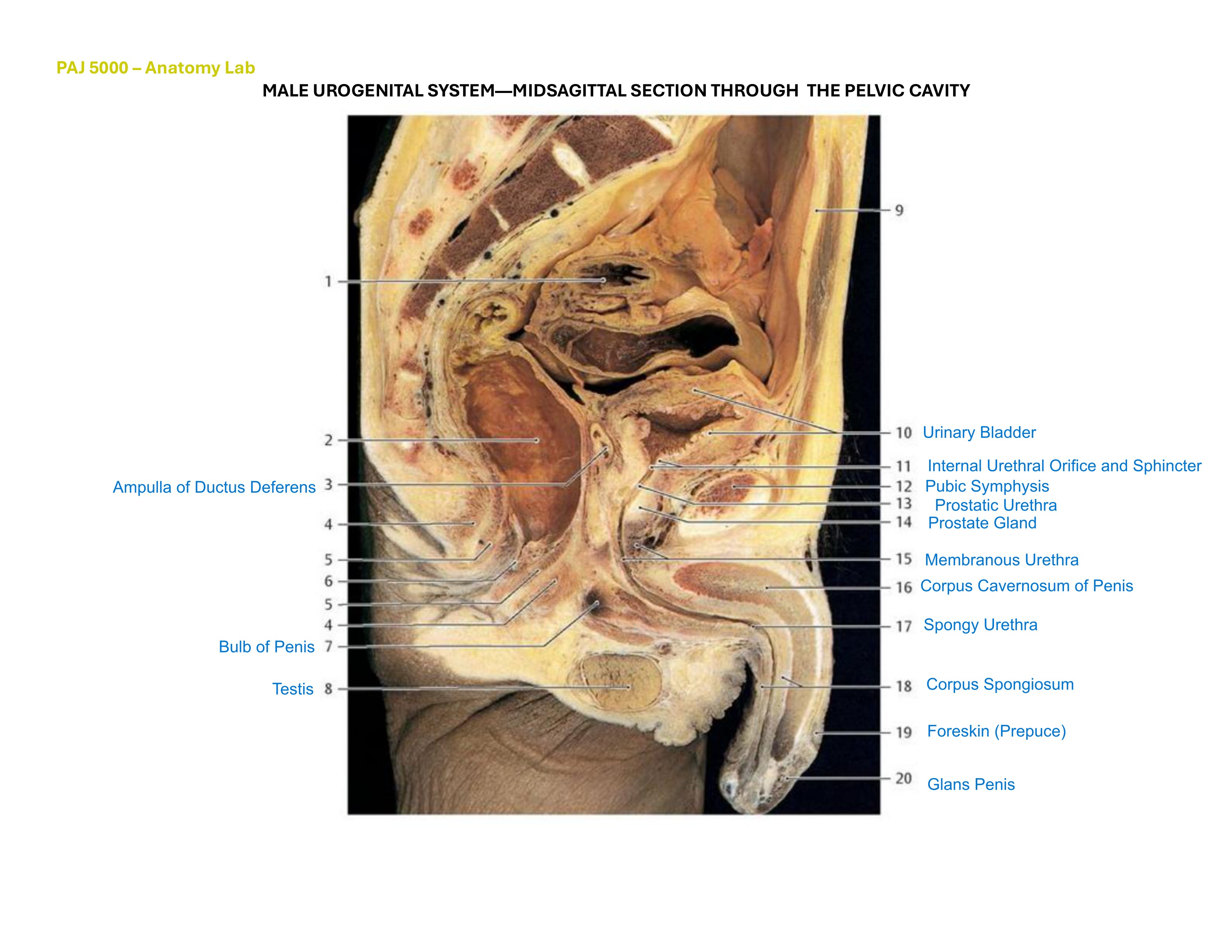 Male Urogenital System — Midsagittal Section Through the Pelvic Cavity, fully labeled