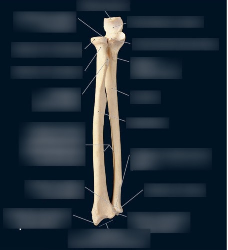 Radius & Ulna — Attachment surfaces for, fully labeled