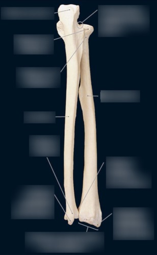 Radius & Ulna — Distal extremity of radius, fully labeled