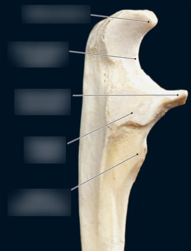 Radius & Ulna — Radial notch, fully labeled