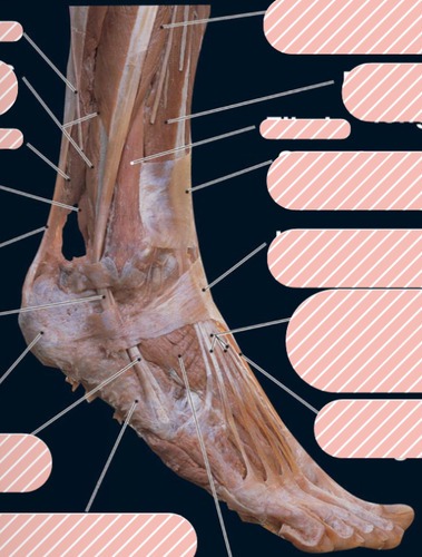Right lateral foot, fully labeled