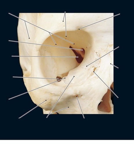 Skull — Anterior View — Nasolacrimal canal of lacrimal, fully labeled