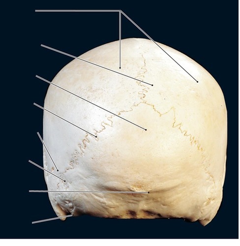 Skull — Bone Identification — Parietal bones, fully labeled
