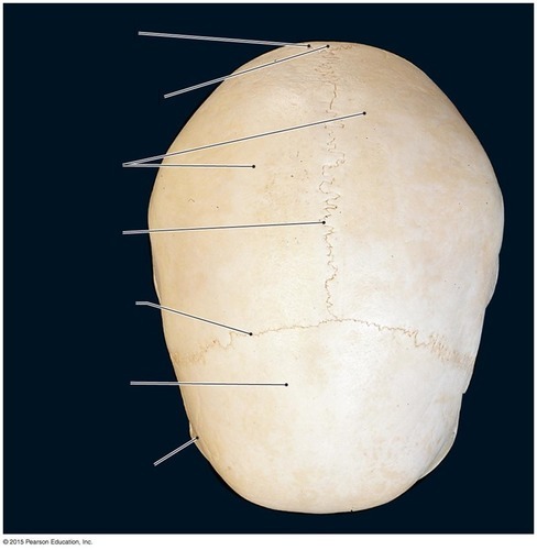 Skull — Superior View (calvaria), fully labeled