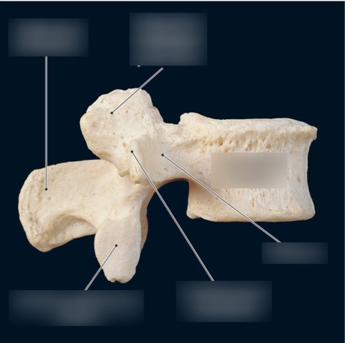 Vertebra — Inferior articular facet, fully labeled