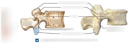 Vertebra — Inferior articular process, fully labeled