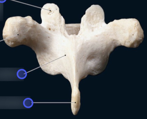 Vertebra — Superior articular facet, fully labeled
