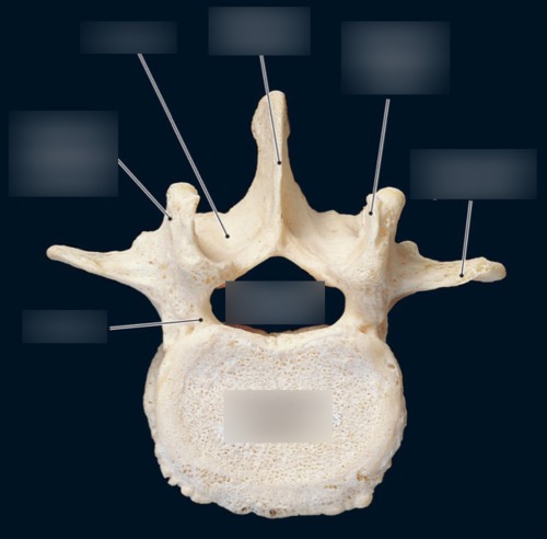 Vertebra — Superior articular process, fully labeled