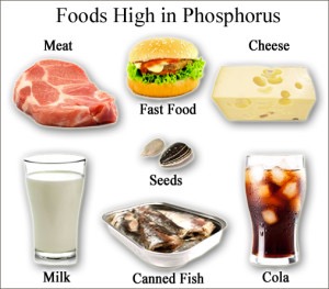 Foods high in phosphorus: meat, fast food (cheeseburger), cheese, seeds, milk, canned fish, and cola.
