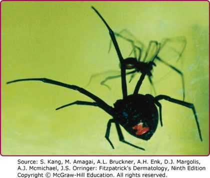 Black widow spider, from the lecture slides