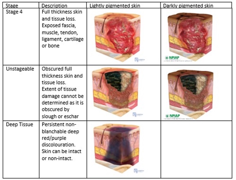 Stage 4, Unstageable and Deep Tissue Injury. Slide 34, likewise an image with no extractable text.