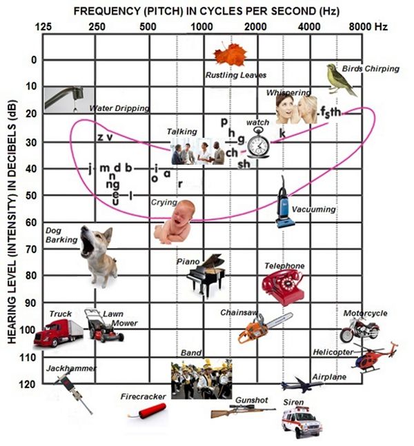 Sensorineural hearing loss, from the lecture slides.
