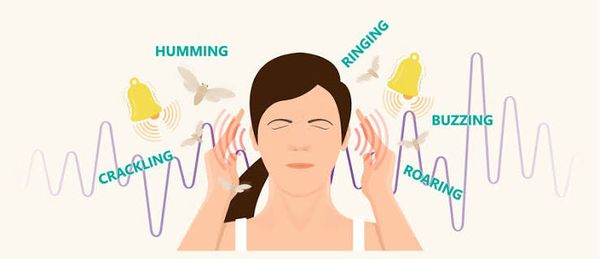 Tinnitus, from the lecture slides.