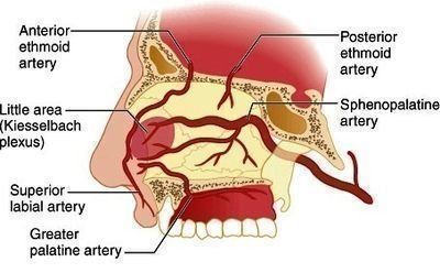Epistaxis   anterior, from the lecture slides.