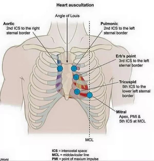 Chest diagram of the heart auscultation sites: aortic at the 2nd intercostal space right sternal border, pulmonic at the 2nd left, Erb's point at the 3rd left, tricuspid at the 5th lower left sternal border, and mitral at the apex in the 5th intercostal space at the midclavicular line.