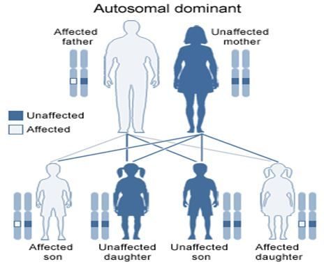 Autosomal dominant pedigree: affected father and unaffected mother with two affected and two unaffected children.
