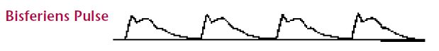 Arterial pulse waveform with two systolic peaks per beat.