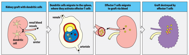 Four-panel strip showing acute kidney rejection: donor dendritic cells in the graft migrate to the spleen, activate effector T cells, which travel back through the blood and destroy the graft.