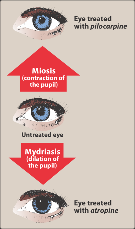 Three photographs of the same eye: treated with pilocarpine showing a constricted pupil, untreated, and treated with atropine showing a widely dilated pupil.