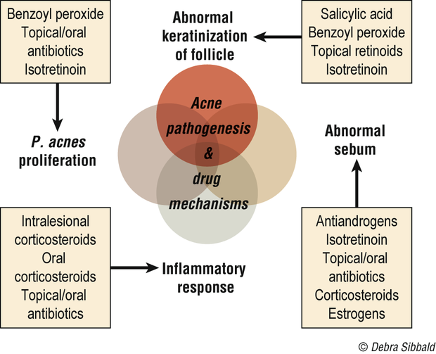 Venn diagram of acne pathogenesis with three overlapping factors — abnormal keratinization of the follicle, Propionibacterium acnes proliferation and abnormal sebum — leading to an inflammatory response, with the drugs that act on each factor listed around it: salicylic acid, benzoyl peroxide, topical retinoids and isotretinoin for keratinization; benzoyl peroxide, topical and oral antibiotics and isotretinoin for the organism; antiandrogens, isotretinoin, topical and oral antibiotics, corticosteroids and estrogens for sebum; and corticosteroids and antibiotics for the inflammatory response.