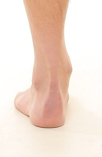 Achilles tendon and malleoli from behind — palpation landmarks marked on a posterior view — patient's left ankle