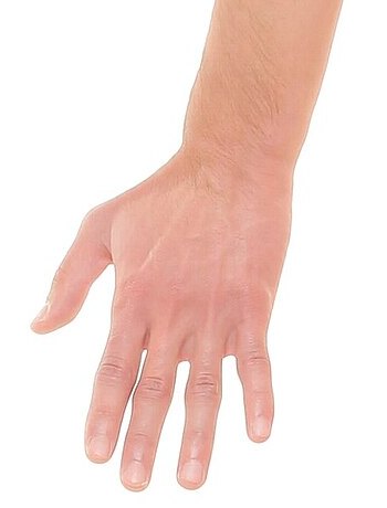 Dorsal surface — palpation landmarks marked on a dorsal view — patient's left hand