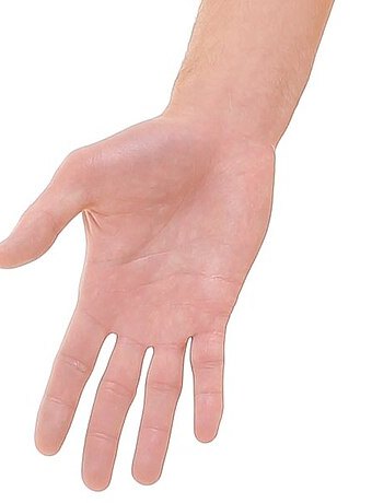 Palmar surface — palpation landmarks marked on a palmar view — patient's right hand