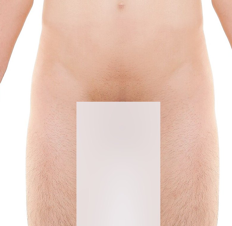 Anterior landmarks — palpation landmarks marked on a anterior view — patient's left hip