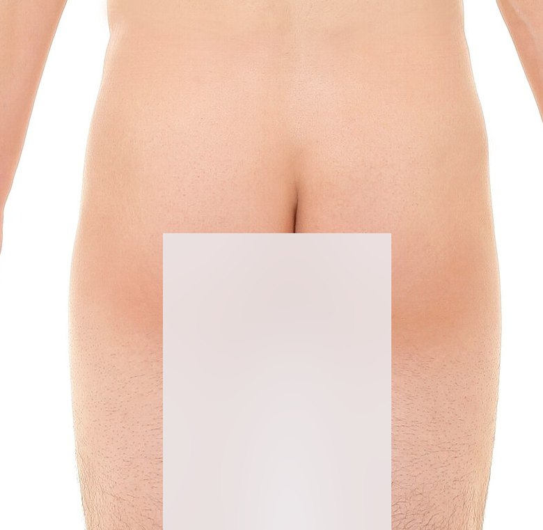 Posterior landmarks — palpation landmarks marked on a posterior view