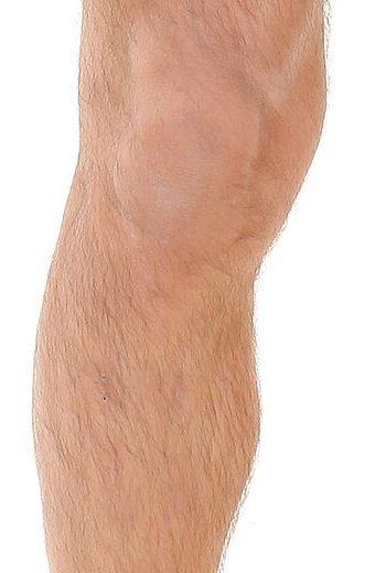 Knee landmarks — palpation landmarks marked on a anterior view — patient's right knee