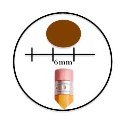Diagram of a brown oval lesion above a ruler segment marked six millimeters, with a pencil eraser drawn beneath it for comparison.