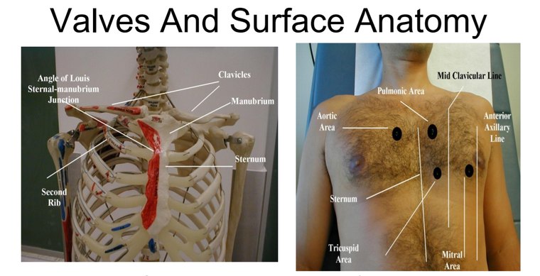 Two panels: a skeleton model with the angle of Louis, clavicles, manubrium, sternum and second rib labeled, and a man's chest marked with dots at the aortic, pulmonic, tricuspid and mitral areas beside the midclavicular and anterior axillary lines.