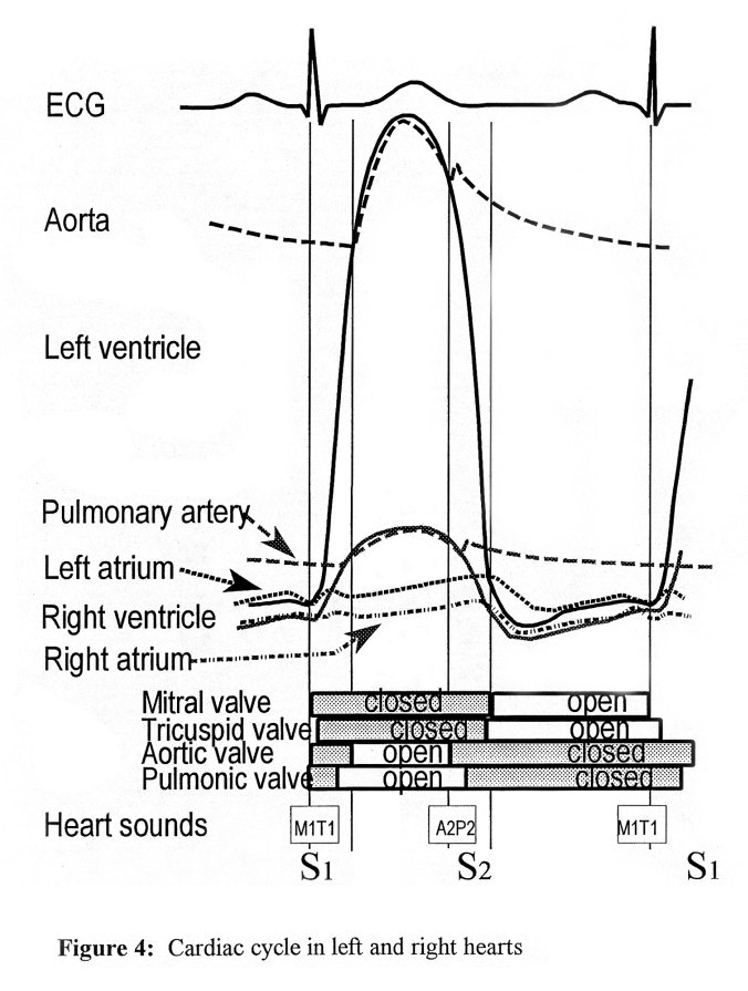 Cardiac cycle diagram with an electrocardiogram trace across the top, pressure curves for the aorta, left ventricle, pulmonary artery, left atrium, right ventricle and right atrium, bars showing when each of the four valves is open or closed, and heart sounds M1 T1 at S1 and A2 P2 at S2 along the bottom.