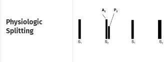 Four vertical bars in sequence, S1, S2, S1, S2, where the first S2 is drawn as two bars labeled A2 and P2 and the second S2 is a single bar.