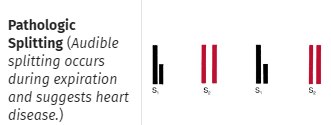 Text reading Pathologic Splitting, audible splitting occurs during expiration and suggests heart disease, beside four bars in which both S2 sounds are drawn doubled.