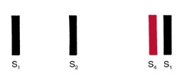 Strip of bars labeled S1, S2, then a red bar S4 immediately before the next S1.