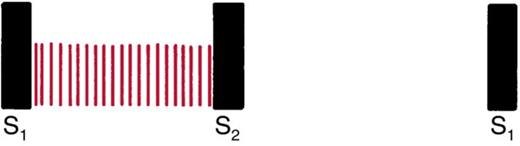 Waveform in which evenly spaced red lines fill the entire interval from S1 to S2 at constant height.