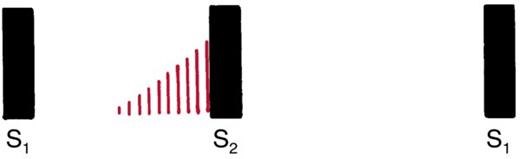 Waveform in which red lines begin midway through systole and rise until they reach S2.