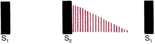 Waveform in which red lines start at S2 at full height and taper away through early diastole.