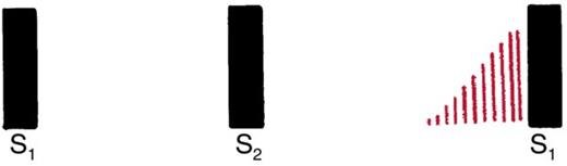 Waveform in which red lines rise in late diastole to reach the next S1.