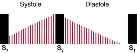 Waveform labeled systole and diastole in which red lines rise to S2 and continue past it, fading through diastole without a break.