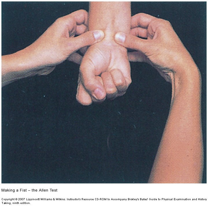 Examiner's two hands compressing a patient's wrist over both the radial and ulnar arteries while the patient makes a tight fist.
