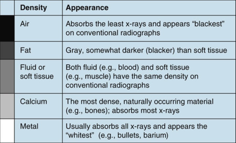 Table of the five basic radiographic densities with a gray-scale bar beside it, listing air, fat, fluid or soft tissue, calcium and metal, each with a description of how much x-ray it absorbs and how it appears.