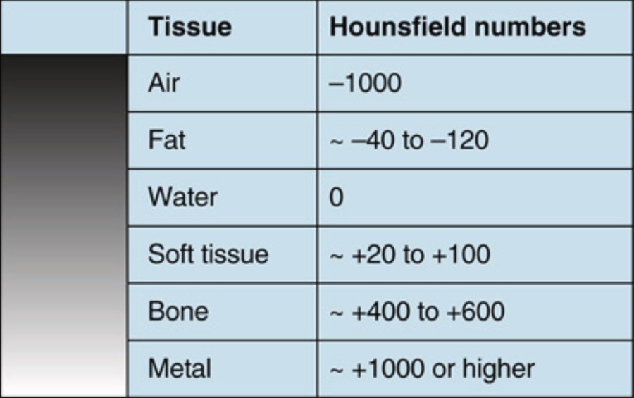 Table headed Tissue and Hounsfield numbers, with a gray-scale bar alongside. Air is minus 1000, fat is approximately minus 40 to minus 120, water is 0, soft tissue is approximately plus 20 to plus 100, bone is approximately plus 400 to plus 600, and metal is approximately plus 1000 or higher.