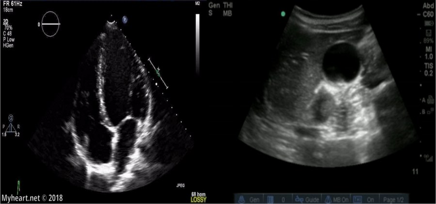 Two ultrasound images side by side. The left is a four-chamber cardiac view with the orientation indicator marker at the top right of the screen; the right is an abdominal view with the indicator marker at the top left.