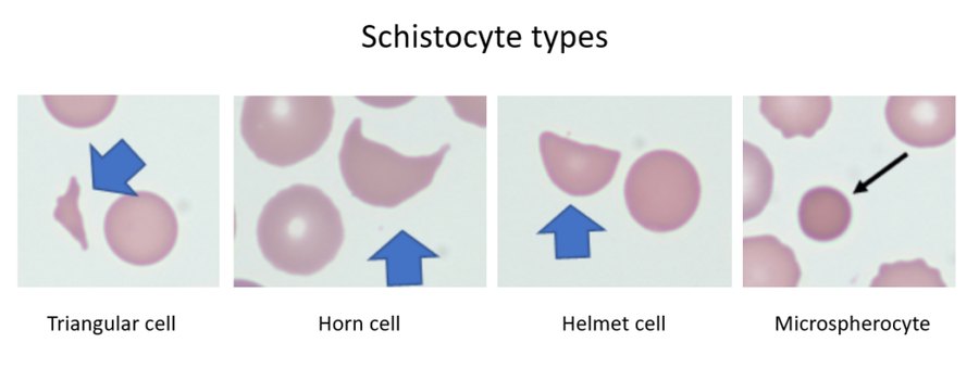 Lecture 4 slide 39 figure.